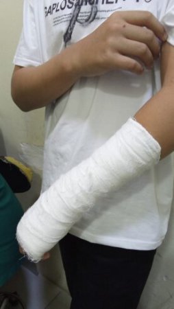 Bu məktəbdə xəsarətlə nəticələnən münaqişə valideyndən GİZLƏDİLDİ - FOTO